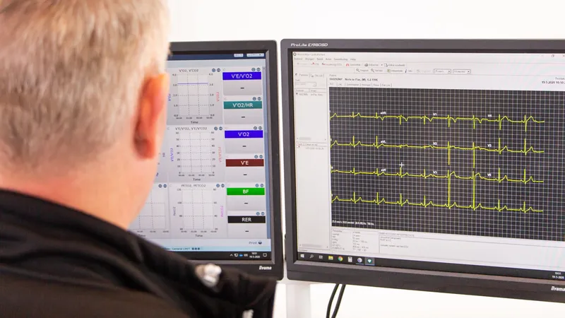 ECG Hartfilmpje Sportmedische keuring
